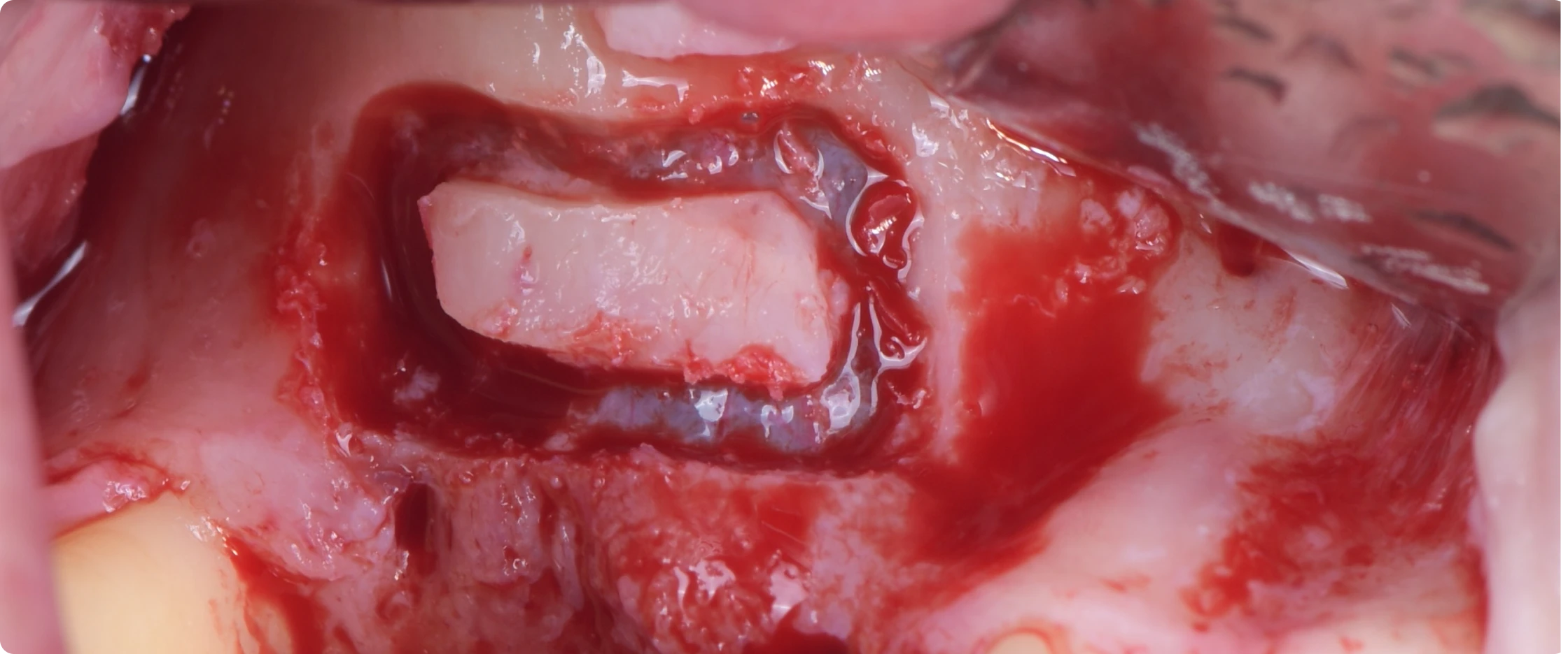 academie-chirurgie-implantaire-gucciardi-paris-6