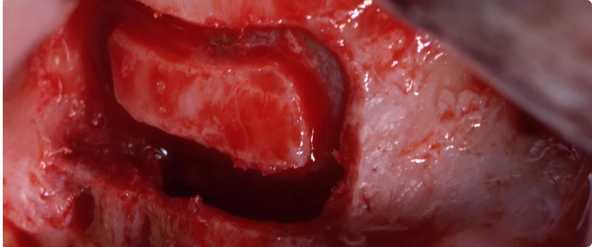 academie-chirurgie-implantaire-gucciardi-paris