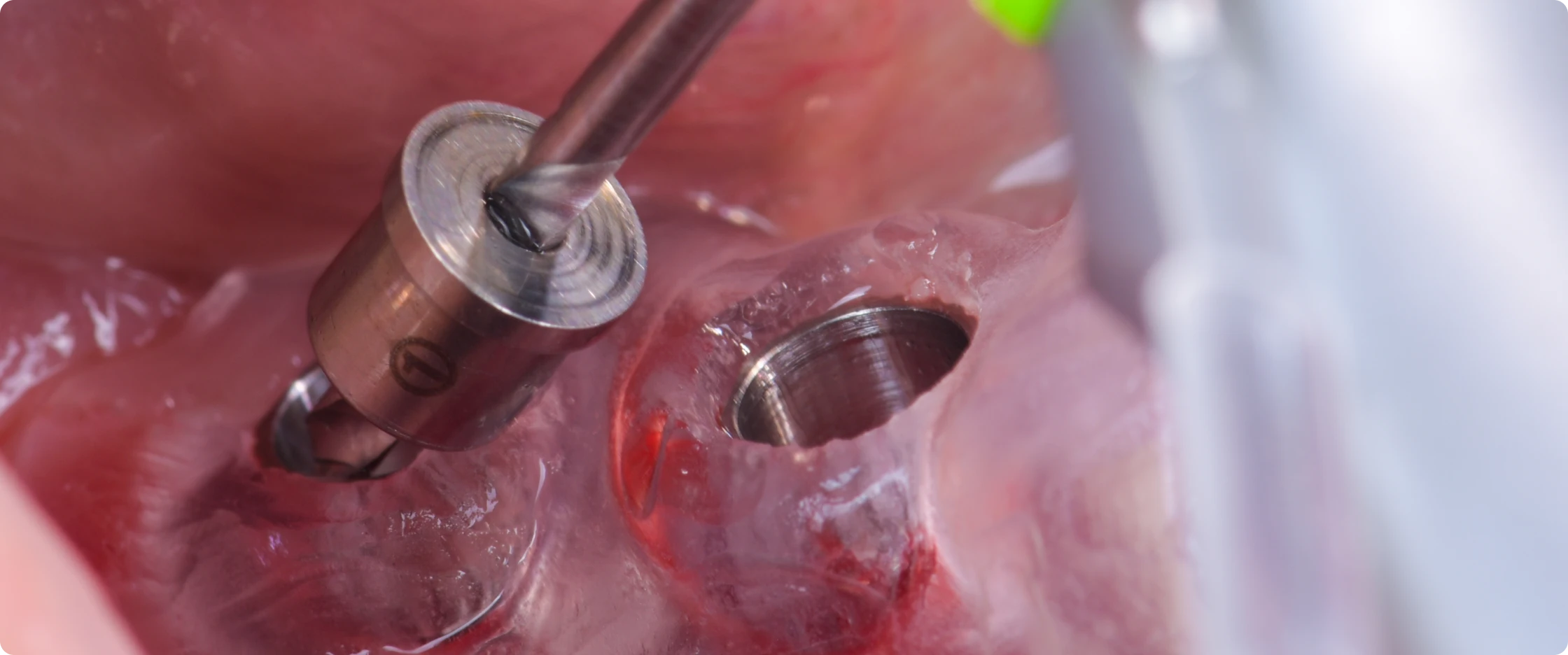 academie-chirurgie-implantaire-paris-6-saint-sulpice