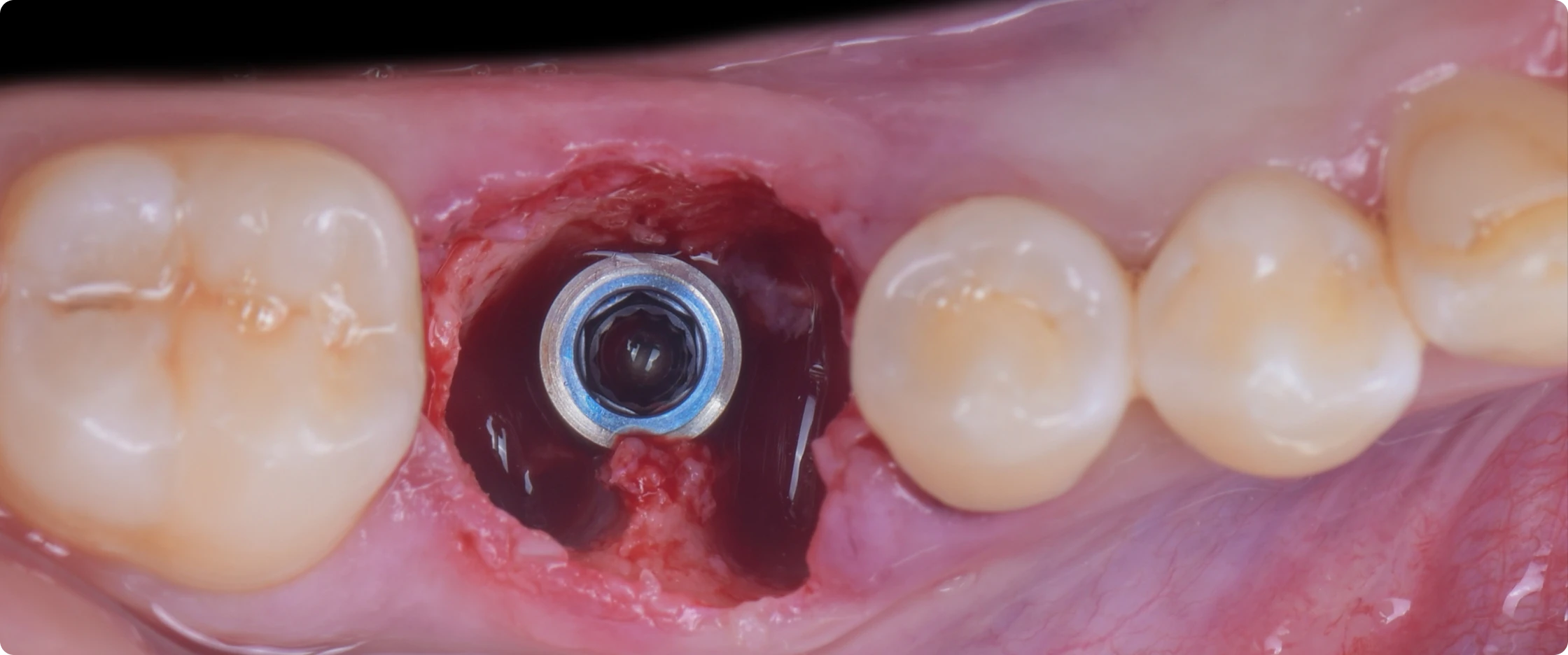 academie-chirurgie-implantaire-paris-6