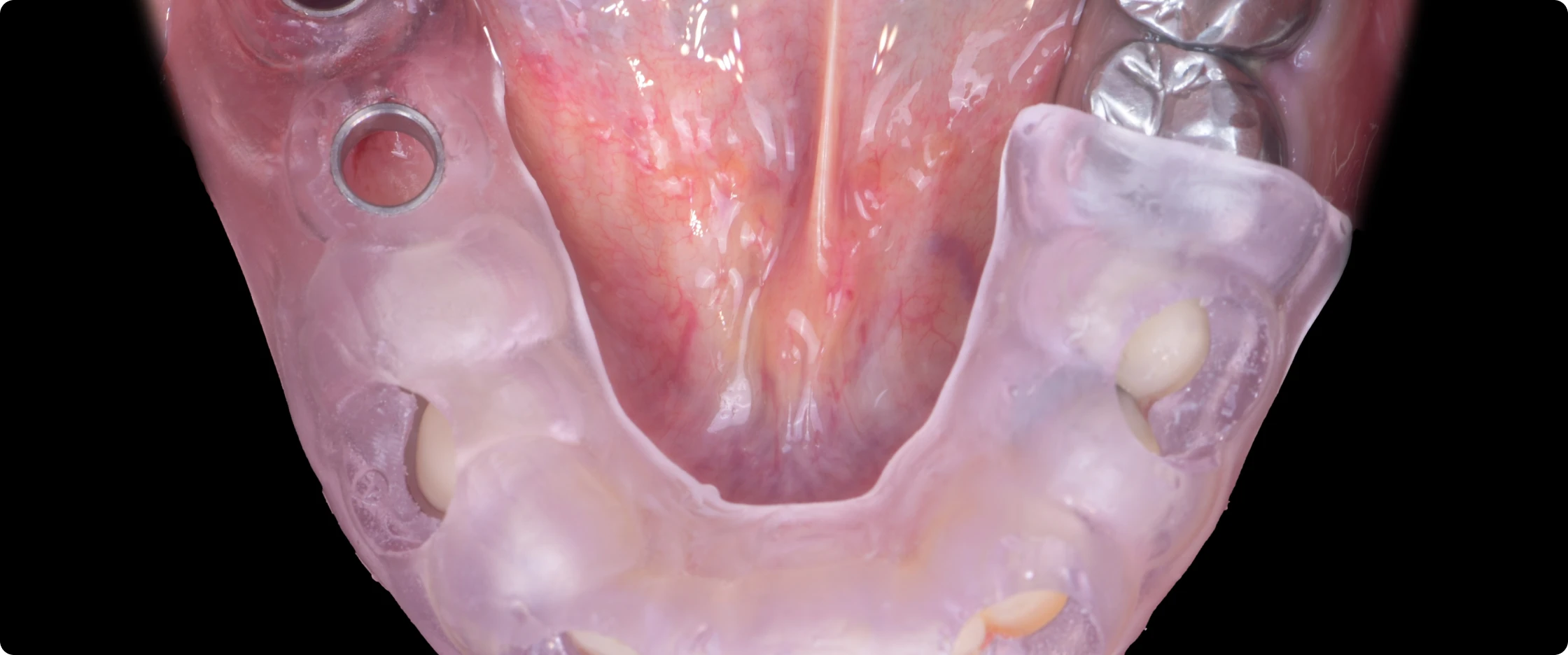 academie-chirurgie-implantaire-paris-saint-sulpice