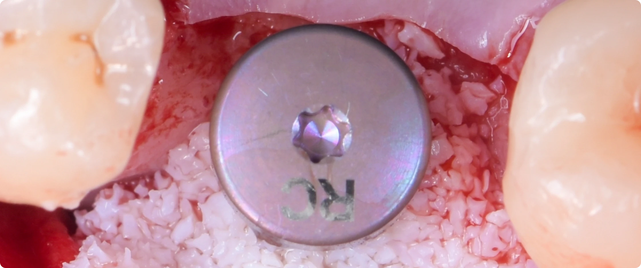 academie-chirurgie-implantaire-paris