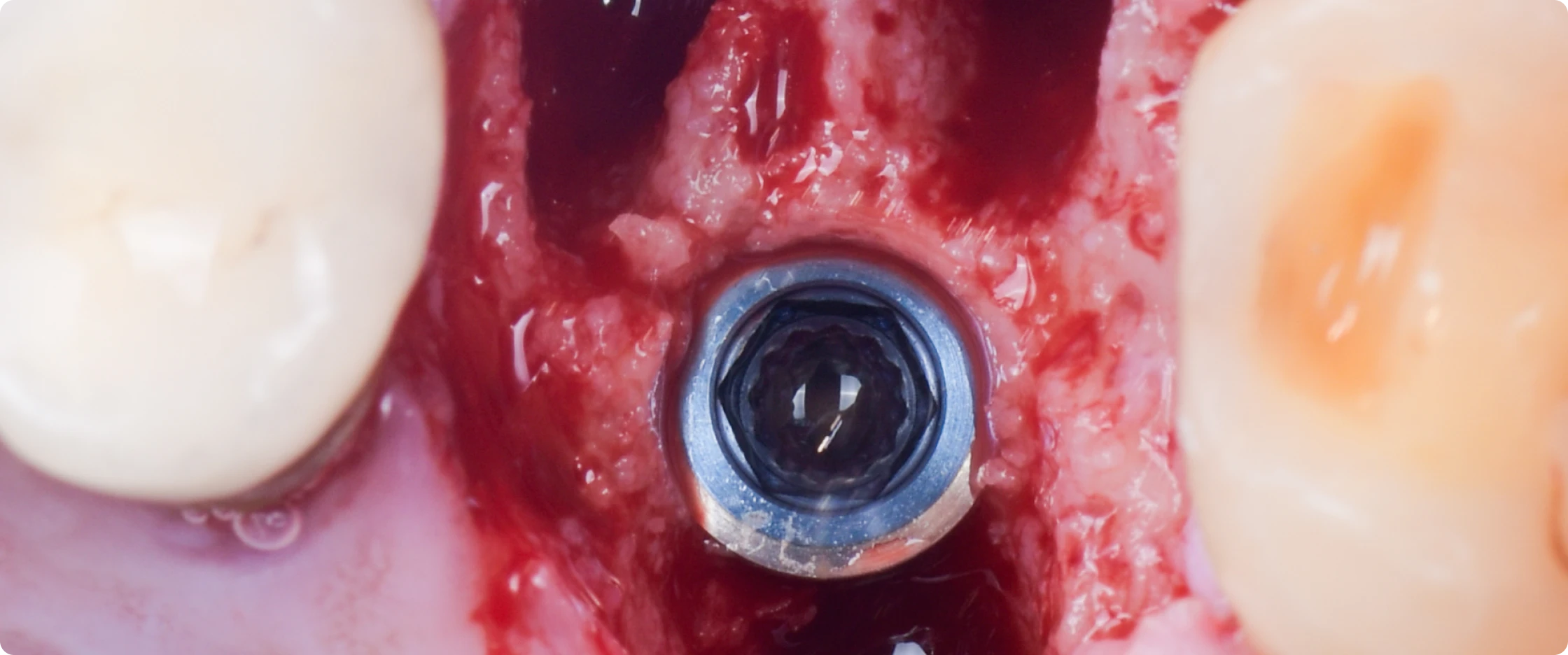 chirurgie-guidee-paris-6