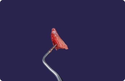 paris-academie-chirurgie-implantaire